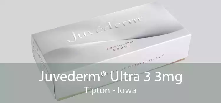 Juvederm® Ultra 3 3mg Tipton - Iowa