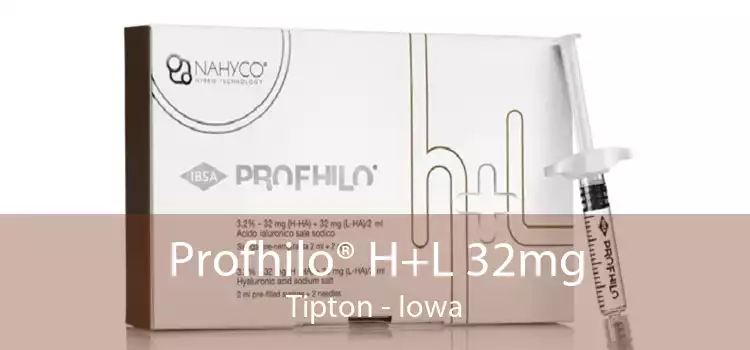 Profhilo® H+L 32mg Tipton - Iowa